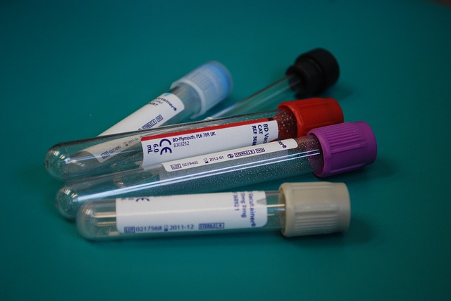 Neuer Bluttest für Brustkrebs